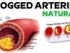 Blocked-Arteries-Cured-Natural-Health-Tips-attachment